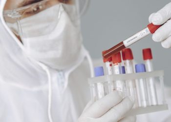 Alza en los casos de Covid -19, notifican 655 y cinco fallecidos