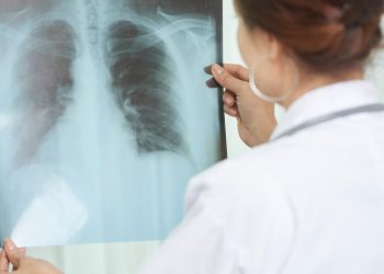 Día Mundial de la Tuberculosis 2021,recomiendan prestar atención a la tos