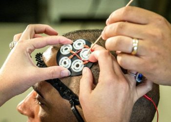 Synchron comienza los ensayos en humanos de implantes cerebrales en seis pacientes con parálisis severa