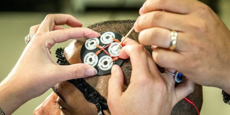 Synchron comienza los ensayos en humanos de implantes cerebrales en seis pacientes con parálisis severa